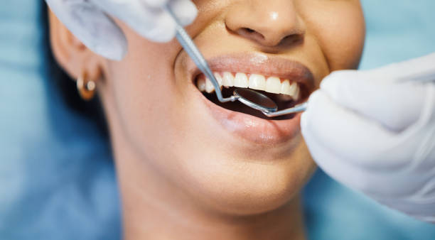 Best Emergency Dental Care for Broken or Chipped Teeth in Edgewood, TX