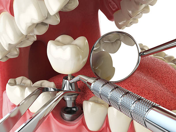Best Emergency Treatment for Dental Infections or Abscesses in Edgewood, TX